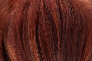 Как лечить пигментные возрастные пятна на лице Как лечить пигментные возрастные пятна на лице