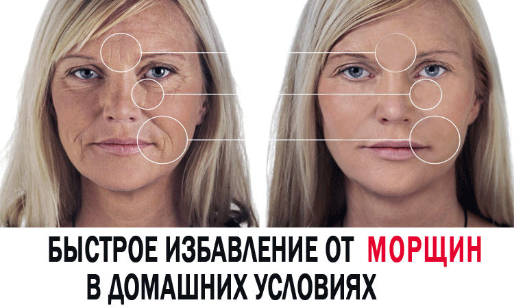 Избавится от морщин в домашних условиях