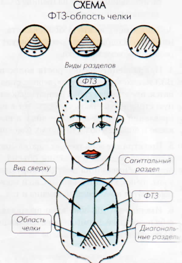 Мужская Стрижка Теменной Зоны