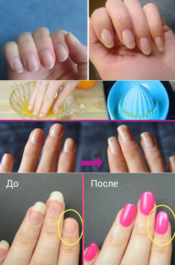 Как отрасти ногти дома