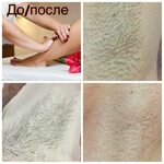 Депиляция бикини. Ваксинг зоны глубокого бикини. Как сделать депиляции интимной зоне. Эпиляция бикини глубокое. Как сделать депиляции интимной зоне.